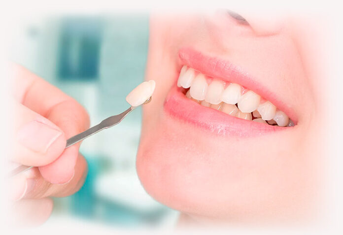 Достоинства и недостатки художественной реставрации зубов